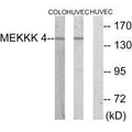 Western blot analysis of extracts from COLO cells and HUVEC cells, using MEKKK 4 antibody.
