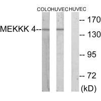 Western blot analysis of extracts from COLO cells and HUVEC cells, using MEKKK 4 antibody.