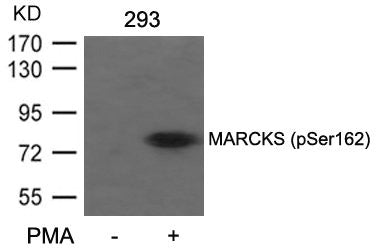 Western blot analysis of extracts from 293 cells untreated or treated with PMA using MARCKS(Phospho-Ser162) Antibody.