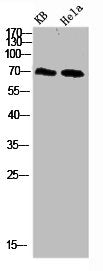 Western blot analysis of 293T Hela 3T3 lysate, antibody was diluted at 500. Secondary antibody  was diluted at 1:20000
