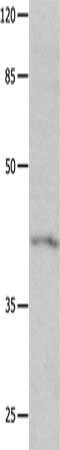 Gel: 10%SDS-PAGE, Lysate: 40 ug, Lane: Mouse heart tissue, Primary antibody: CSB-PA781942(KCNA5 Antibody) at dilution 1/200, Secondary antibody: Goat anti rabbit IgG at 1/8000 dilution, Exposure time: 10 seconds