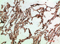Immunohistochemical analysis of paraffin-embedded human-lung, antibody was diluted at 1:200