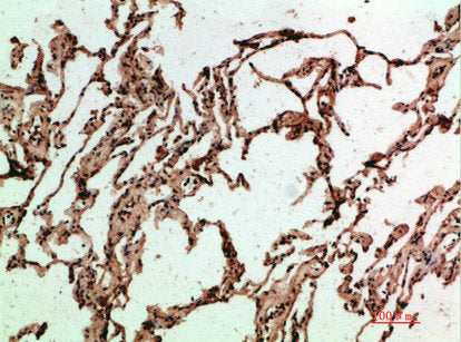Immunohistochemical analysis of paraffin-embedded human-lung, antibody was diluted at 1:200
