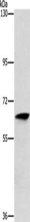 Gel: 10%SDS-PAGE, Lysate: 40 ug, Lane: Human lymphoma tissue, Primary antibody: CSB-PA782102(ALG6 Antibody) at dilution 1/350, Secondary antibody: Goat anti rabbit IgG at 1/8000 dilution, Exposure time: 30 seconds
