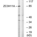 Western blot analysis of extracts from COS cells, using ZC11A antibody.