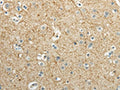 The image on the left is immunohistochemistry of paraffin-embedded Human brain tissue using CSB-PA782193(WNT2 Antibody) at dilution 1/40, on the right is treated with synthetic peptide. (Original magnification: ×200)
