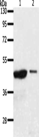 Gel: 10%SDS-PAGE, Lysate: 40 ug, Lane 1-2: 231 cells, A549 cells, Primary antibody: CSB-PA782584(AADACL4 Antibody) at dilution 1/100, Secondary antibody: Goat anti rabbit IgG at 1/8000 dilution, Exposure time: 30 minutes