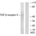 Western blot analysis of extracts from HepG2 cells, using TGF β Receptor II antibody.