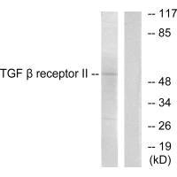 Western blot analysis of extracts from HepG2 cells, using TGF β Receptor II antibody.