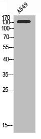 Western blot analysis of A549 using PI 3-Kinase C2γ antibody.. Secondary antibody  was diluted at 1:20000
