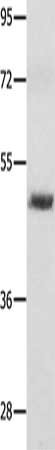 Gel: 10%SDS-PAGE, Lysate: 40 ug, Lane: 231 cells, Primary antibody: CSB-PA783063(MITF Antibody) at dilution 1/600, Secondary antibody: Goat anti rabbit IgG at 1/8000 dilution, Exposure time: 1 minute