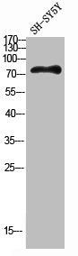 Western blot analysis of SH-SY5Y lysis using HGF antibody. Antibody was diluted at 1:500. Secondary antibody  was diluted at 1:20000