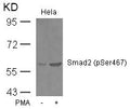 Western blot analysis of extracts from Hela cells untreated or treated with PMA using Smad2(Phospho-Ser467) Antibody.