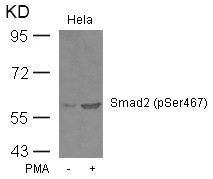 Western blot analysis of extracts from Hela cells untreated or treated with PMA using Smad2(Phospho-Ser467) Antibody.