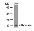 Western blot analysis of extracts from Hela cells using a-Synuclein(Ab-133) Antibody.