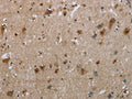 The image on the left is immunohistochemistry of paraffin-embedded Human brain tissue using CSB-PA784072(EGFL8 Antibody) at dilution 1/30, on the right is treated with fusion protein. (Original magnification: ×200)