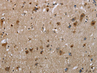 The image on the left is immunohistochemistry of paraffin-embedded Human brain tissue using CSB-PA784072(EGFL8 Antibody) at dilution 1/30, on the right is treated with fusion protein. (Original magnification: ×200)