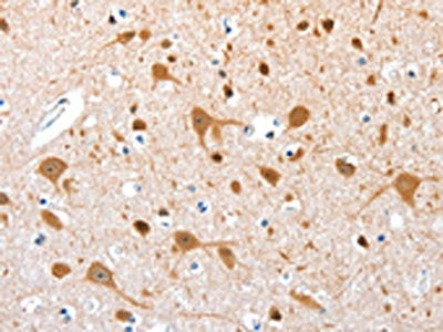 The image on the left is immunohistochemistry of paraffin-embedded Human brain tissue using CSB-PA784753(AEBP2 Antibody) at dilution 1/25, on the right is treated with fusion protein. (Original magnification: ×200)
