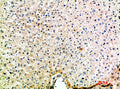 Immunohistochemical analysis of paraffin-embedded human-liver, antibody was diluted at 1:200