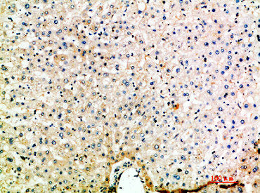 Immunohistochemical analysis of paraffin-embedded human-liver, antibody was diluted at 1:200