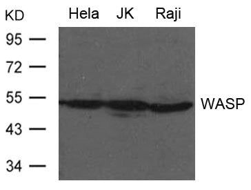 Western blot analysis of extract from Hela, JK and Raji cells using WASP Antibody