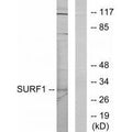 Western blot analysis of extracts from Jurkat cells, using SURF1 antibody.
