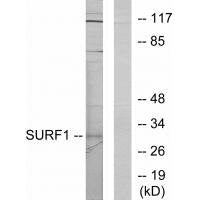 Western blot analysis of extracts from Jurkat cells, using SURF1 antibody.