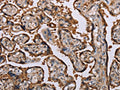 The image on the left is immunohistochemistry of paraffin-embedded Human placenta tissue using CSB-PA786029(KIF2A Antibody) at dilution 1/70, on the right is treated with fusion protein. (Original magnification: ×200)