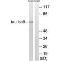 Western blot analysis of extracts from rat brain cells, using Tau (Ab-534/217) antibody.