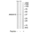 Western blot analysis of extracts from HeLa cell and NIH-3T3 cells, using ANXA10 antibody.