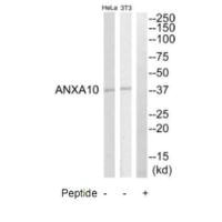 Western blot analysis of extracts from HeLa cell and NIH-3T3 cells, using ANXA10 antibody.