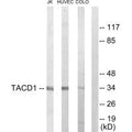 Western blot analysis of extracts from Jurkat cells, HuvEc cells and COLO205 cells, using TACD1 antibody.