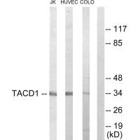 Western blot analysis of extracts from Jurkat cells, HuvEc cells and COLO205 cells, using TACD1 antibody.