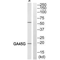 Western blot analysis of extracts from HeLa cells, using LEG7 antibody.