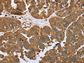 IKBKE Antibody – Figure 1 of 2
