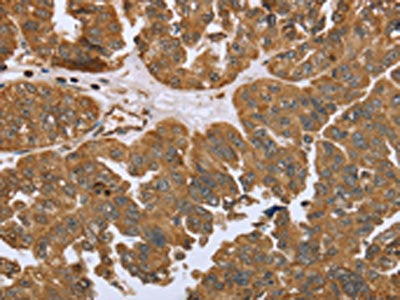 IKBKE Antibody – Figure 1 of 2