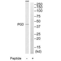 Western blot analysis of extracts from A549 cells, using PGD antibody.