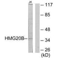 Western blot analysis of extracts from Jurkat cells, using HMG20B antibody.
