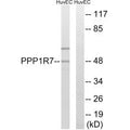 Western blot analysis of extracts from HUVEC cells, using PPP1R7 antibody.