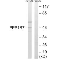 Western blot analysis of extracts from HUVEC cells, using PPP1R7 antibody.