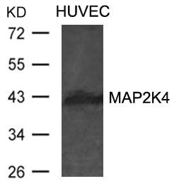Western blot analysis of extracts from HUVEC cells using MAP2K4 Antibody.