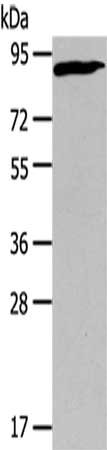 Gel: 6%SDS-PAGE,Lysate: 40 ug,,Primary antibody: CSB-PA788466(CUL2 Antibody) at dilution 1/440 dilution,Secondary antibody: Goat anti rabbit IgG at 1/8000 dilution,Exposure time: 3 minutes