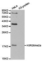 Western blot analysis of extracts of HeLa cell line and H3 protein expressed in E.coli., using H3R26me2a antibody.