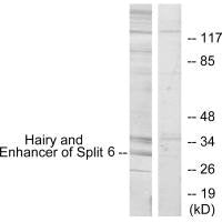 Western blot analysis of extracts from HeLa cells, using HES6 antibody.