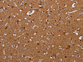 The image on the left is immunohistochemistry of paraffin-embedded Human brain tissue using CSB-PA788951(LUM Antibody) at dilution 1/20, on the right is treated with fusion protein. (Original magnification: ×200)