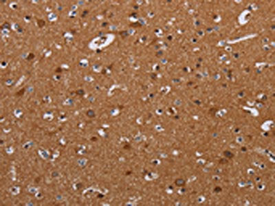 The image on the left is immunohistochemistry of paraffin-embedded Human brain tissue using CSB-PA788951(LUM Antibody) at dilution 1/20, on the right is treated with fusion protein. (Original magnification: ×200)