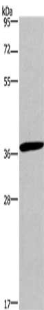 Gel: 10%SDS-PAGE, Lysate: 40 ug, Lane: Jurkat cells, Primary antibody: CSB-PA789186(CD1A Antibody) at dilution 1/550, Secondary antibody: Goat anti rabbit IgG at 1/8000 dilution, Exposure time: 1 minute