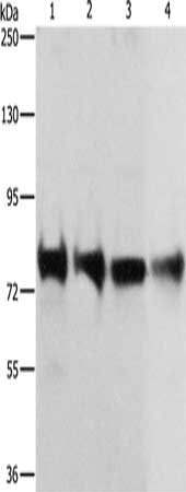 Gel: 8%SDS-PAGE, Lysate: 40 ug, Lane 1-4: 293T cells, hela cells, Jurkat cells, Lovo cells, Primary antibody: CSB-PA789505(CDH6 Antibody) at dilution 1/300, Secondary antibody: Goat anti rabbit IgG at 1/8000 dilution, Exposure time: 2 minutes