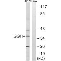 Western blot analysis of extracts from RAW264.7 cells, using GGH antibody.