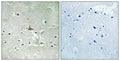 Immunohistochemical analysis of paraffin-embedded human brain tissue using Trk B (Phospho-Tyr706/Tyr707) antibody (left)or the same antibody preincubated with blocking peptide (right).